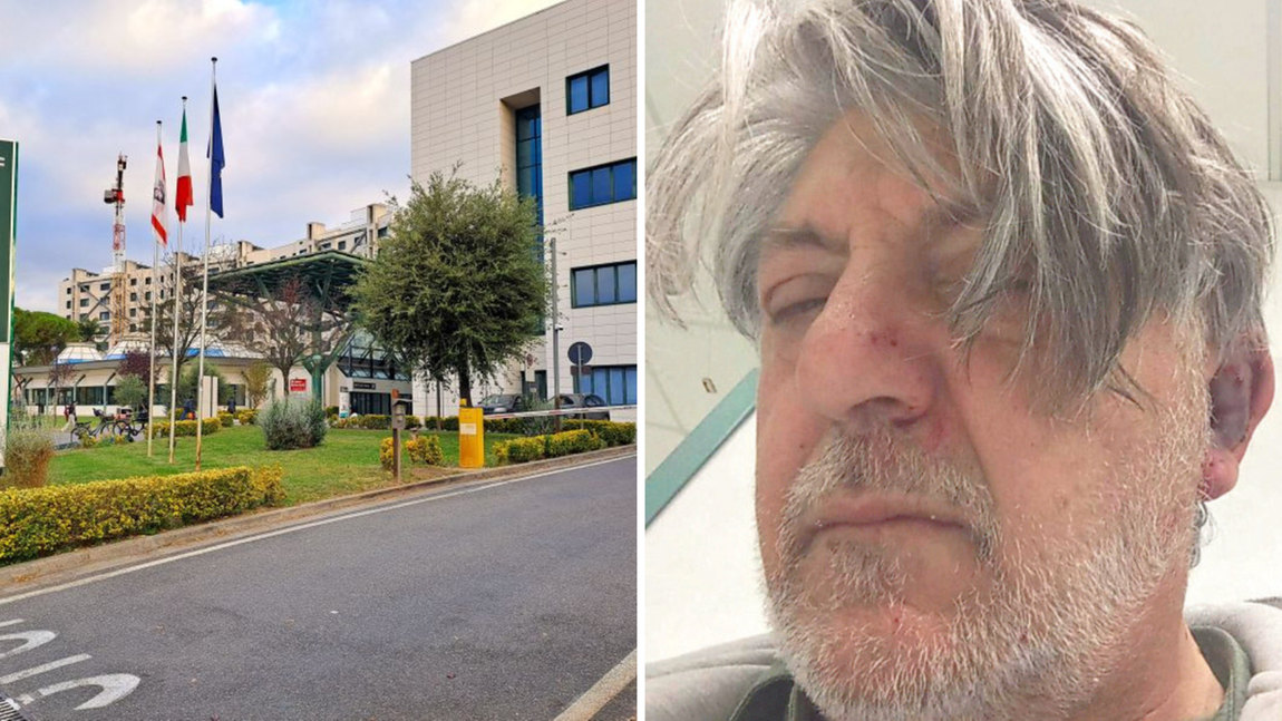 A destra Giovanni Elefante dopo l'aggressione