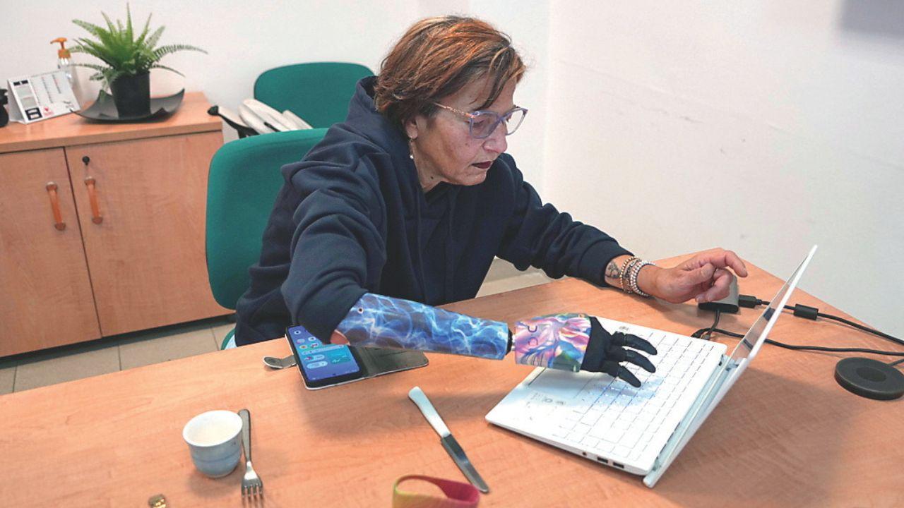 Cinzia D’Amicis, nata senza l’avambraccio destro, scrive al computer con la nuova mano bionica (foto Stick)
