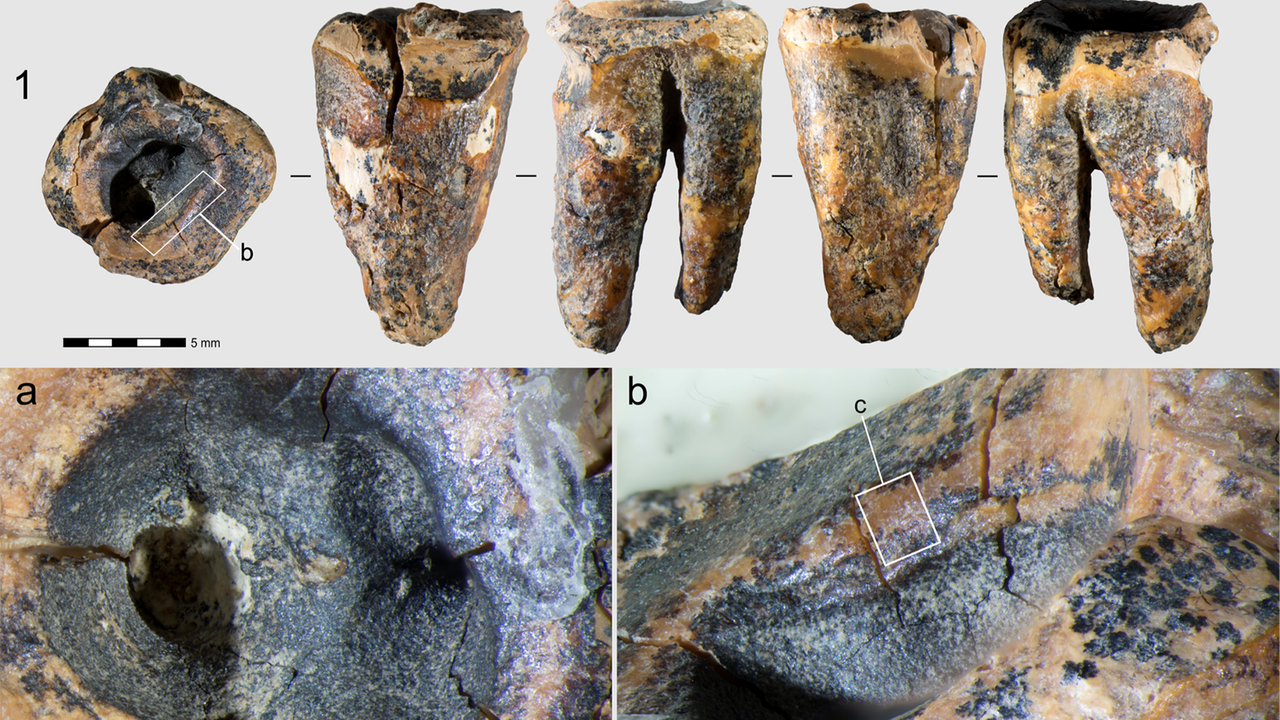 Il dentista dei Neanderthal: 59mila anni fa curavano le carie con trapani di pietra