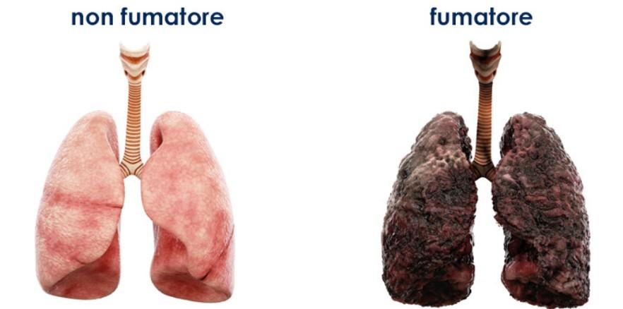 L’effetto del fumo di sigarette sui polmoni, lo studio rivela una risposta choc – Ecco che cosa sappiamo