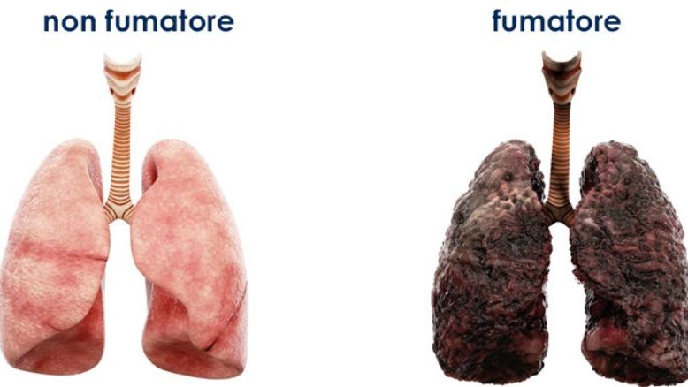 L’effetto del fumo di sigarette sui polmoni, lo studio rivela una risposta choc – Ecco che cosa sappiamo