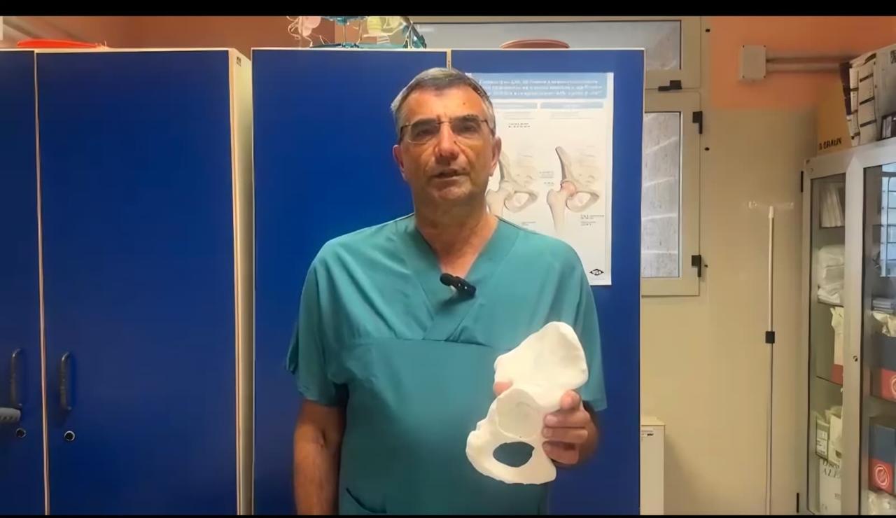 Chirurgia in Sardegna, al Policlinico il primo intervento di ricostruzione articolare dell’anca con protesi 3D e trapianto osseo