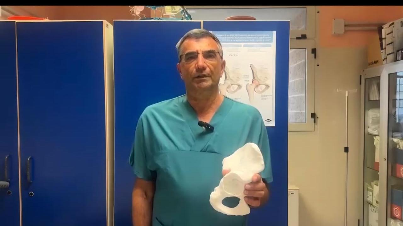 Chirurgia in Sardegna, al Policlinico il primo intervento di ricostruzione articolare dell’anca con protesi 3D e trapianto osseo