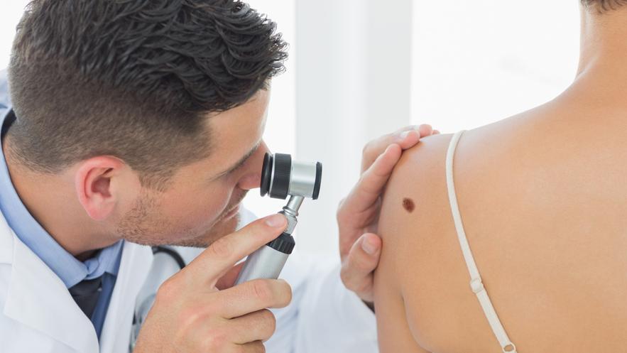 In Toscana si registrano ogni anno tra i 1.000 e i 1.600 nuovi casi di melanoma cutaneo; sotto i 50 anni è il primo tumore diagnosticato negli uomini (14%) e il terzo tra le donne (10%)