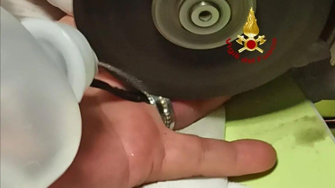 Grosseto, dito gonfio e anello bloccato: al pronto soccorso devono intervenire i vigili del fuoco