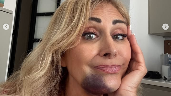 Paura per la mamma di Chiara Ferragni, incidente stradale in vacanza: «Poteva andare molto peggio»