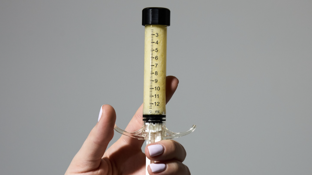 AlloClae, iniezioni di grasso di cadavere per dimagrire: dopo l’Ozempic arriva il nuovo folle metodo per rimodellare il corpo