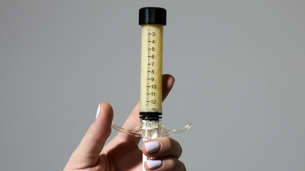 AlloClae, iniezioni di grasso di cadavere per dimagrire: dopo l’Ozempic arriva il nuovo folle metodo per rimodellare il corpo