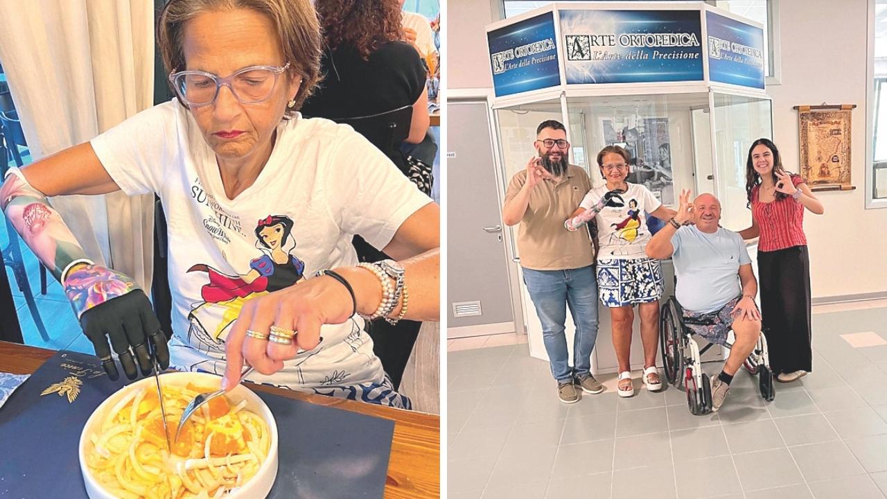 
	Cinzia e la sua nuova mano bionica&nbsp;

