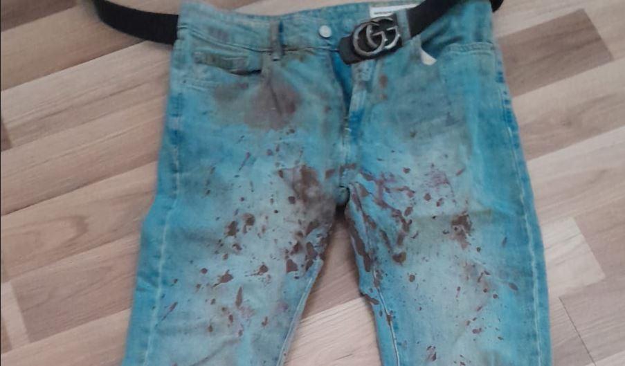 Botte a Lido Estensi, il padre del ragazzo ferito: «Gli hanno rotto il naso»