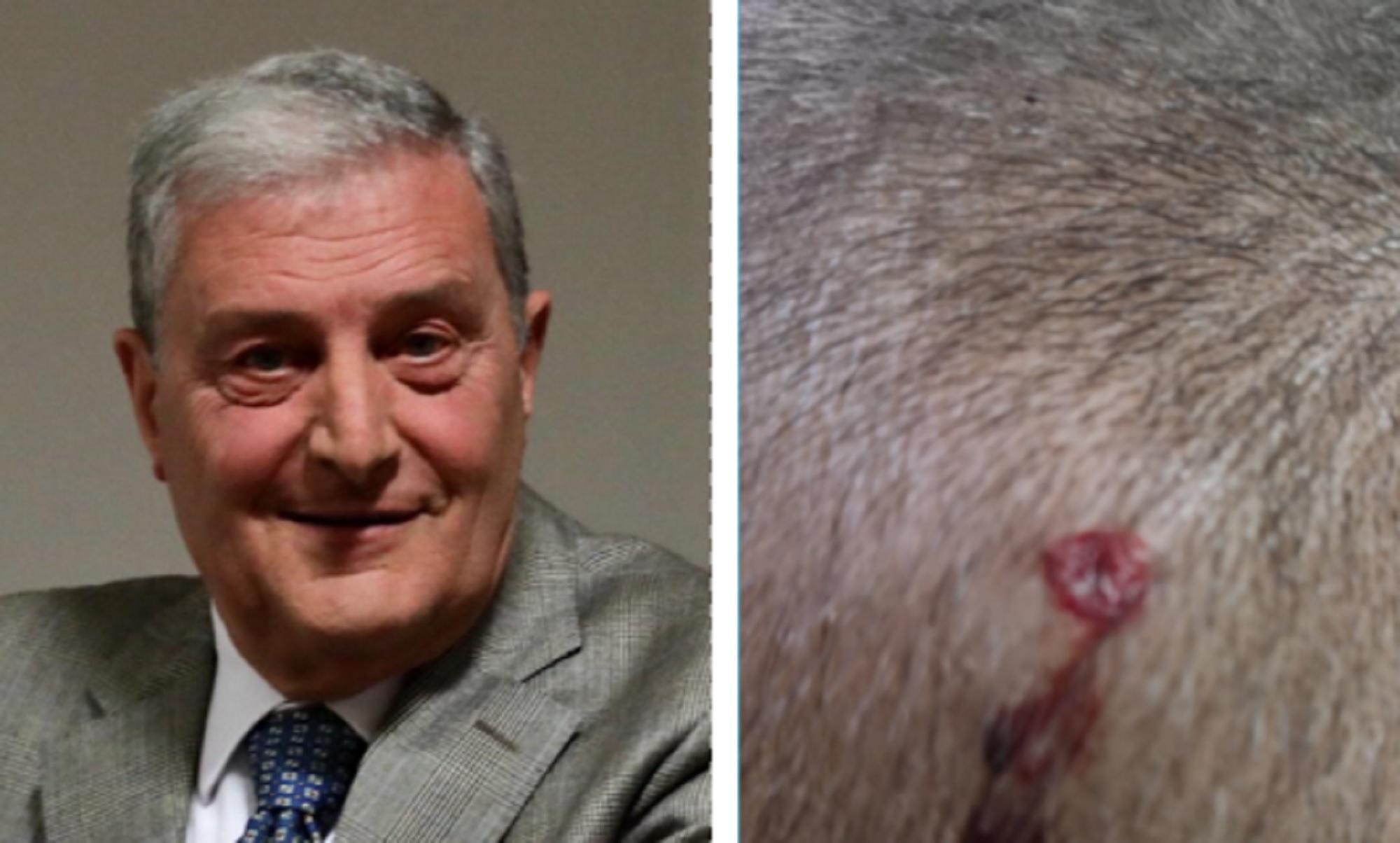 Livorno, spari a una bimba - Per Canaccini l'incubo è finito: «Io estraneo, ma lo sapevano tutti»