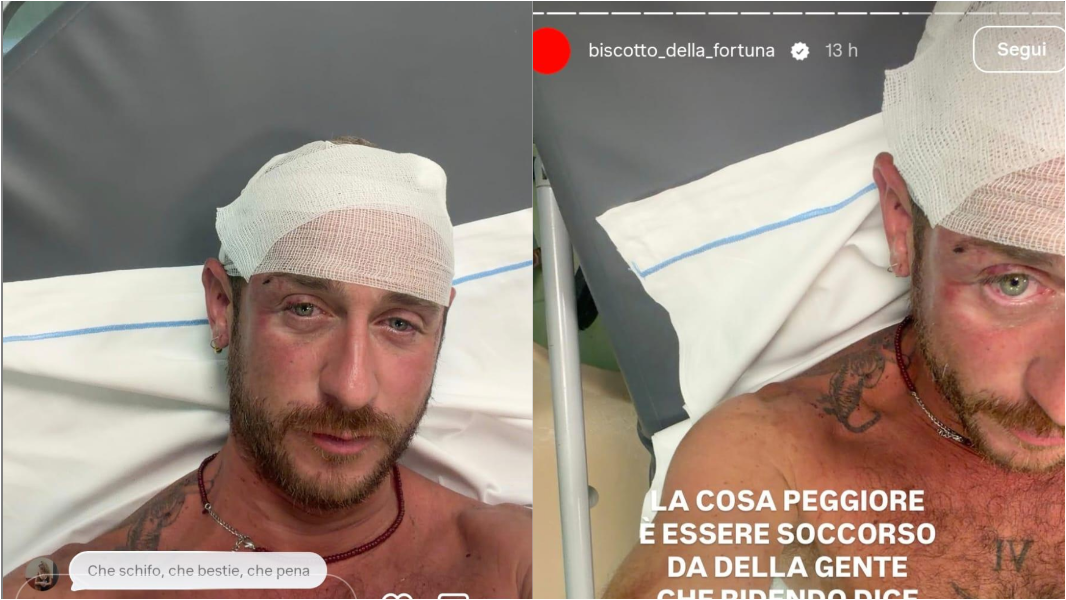 Brutale pestaggio in spiaggia: «Mi hanno preso a sassate e calci in 30» – Cosa sappiamo