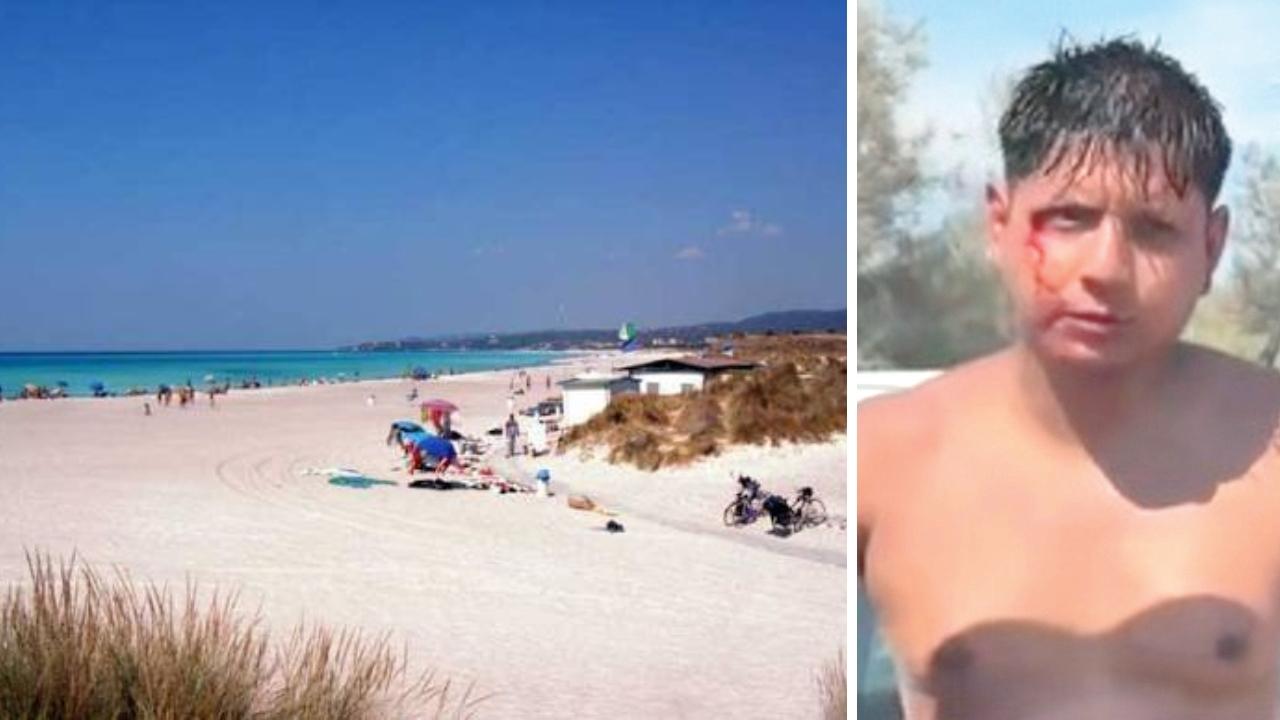 
	Le Spiagge Bianche e Cesar Mendieta dopo i colpi subiti


