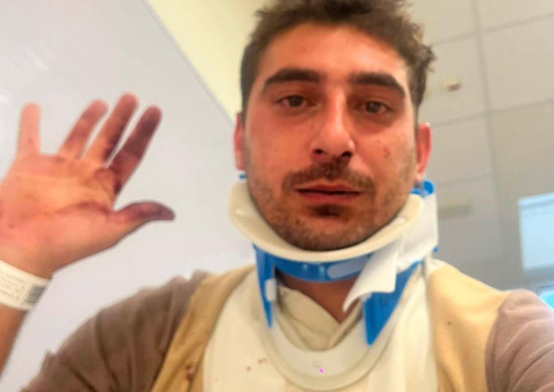 Corporeno, due ragazzi aggrediti dal branco: «Abbiamo pensato di morire»