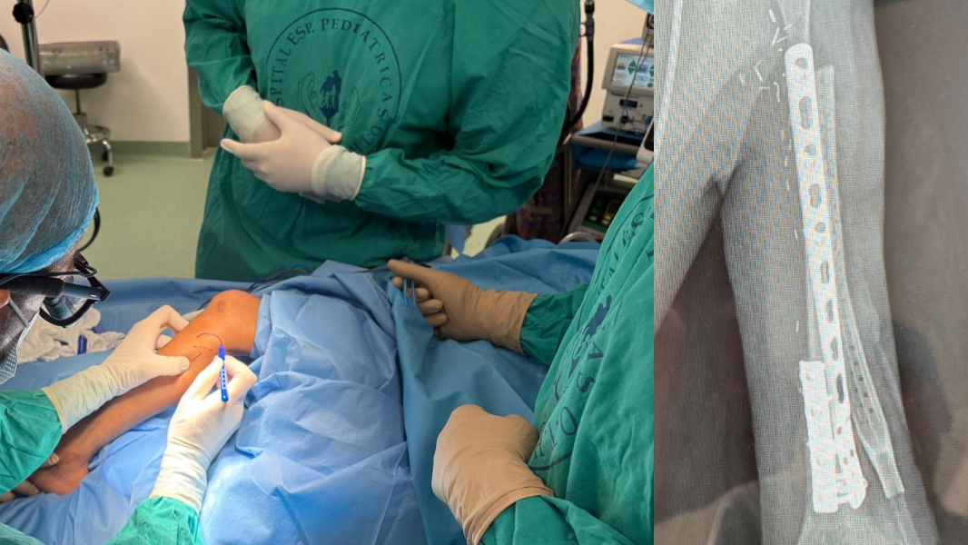 Bimbo di otto anni rischia l'amputazione del braccio, salvato dall'intervento record di un chirurgo sardo