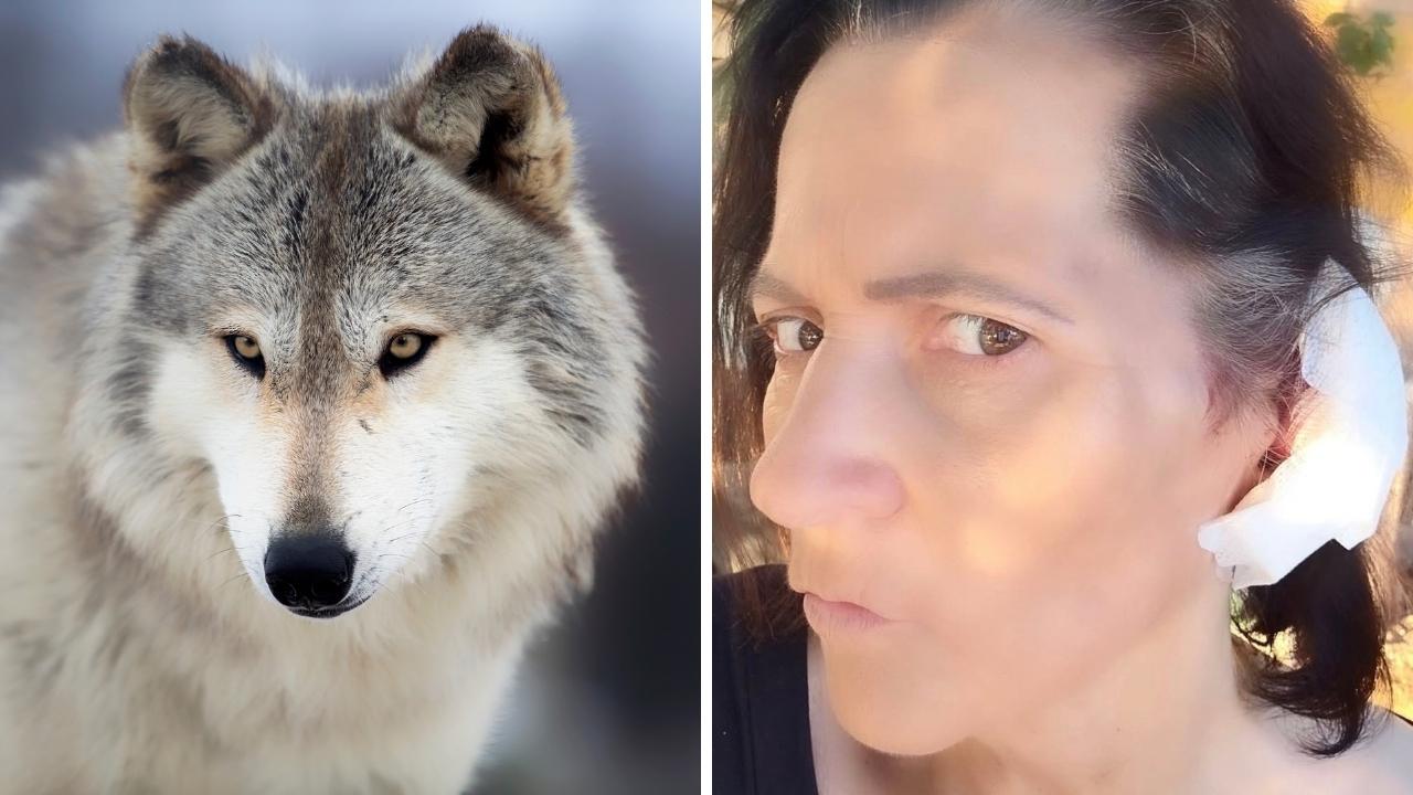 La ferita all'orecchio di Marisa Aronne, aggredita da un lupo nel bosco