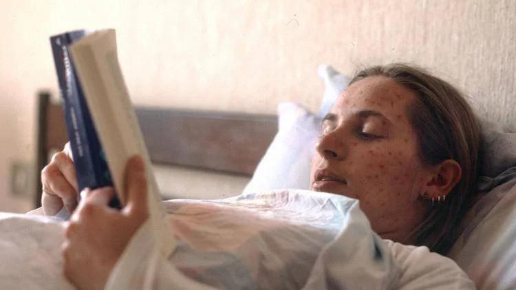 Morbillo, in Italia aumentano i casi: ecco le Regioni più a rischio – L’allarme del Ministero
