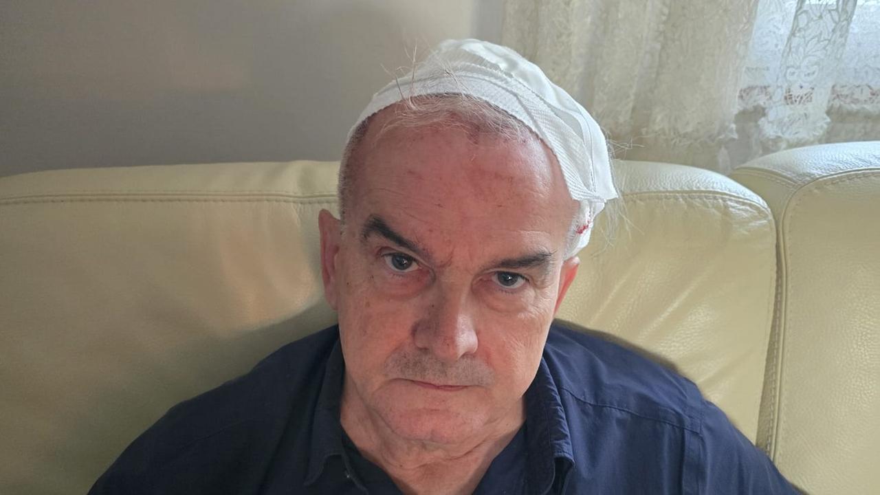 Ferrara, sorprende i ladri in casa: professore di Unife aggredito e colpito alla testa