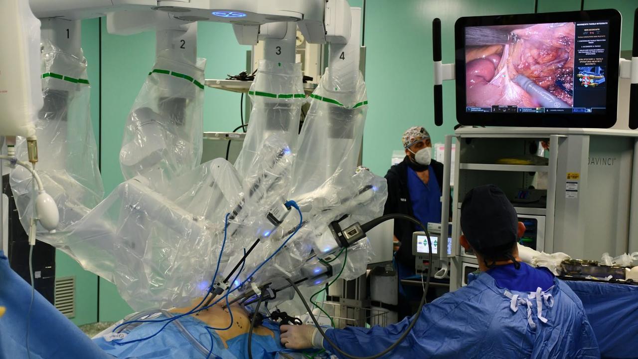 Tumore del colon-retto: 250 interventi robotici all’Aou di Sassari, 169 per neoplasie