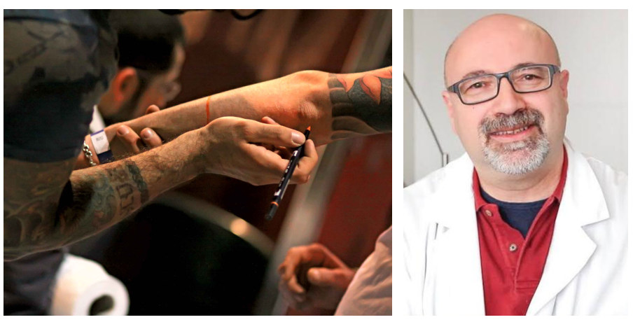 «Tatuaggi, perché rimuoverli non è così facile: non bastano due o tre sedute»