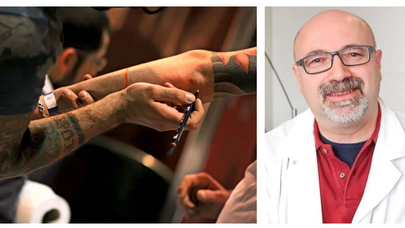 «Tatuaggi, perché rimuoverli non è così facile: non bastano due o tre sedute»