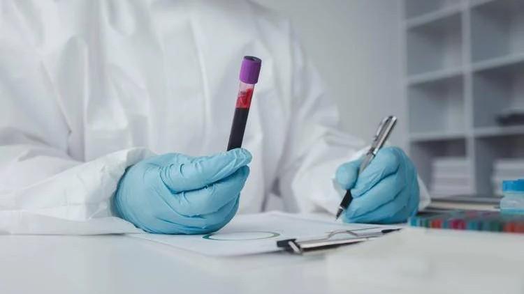 Virus Shamonda, individuato il primo caso umano al mondo: il paziente è morto – L’alert