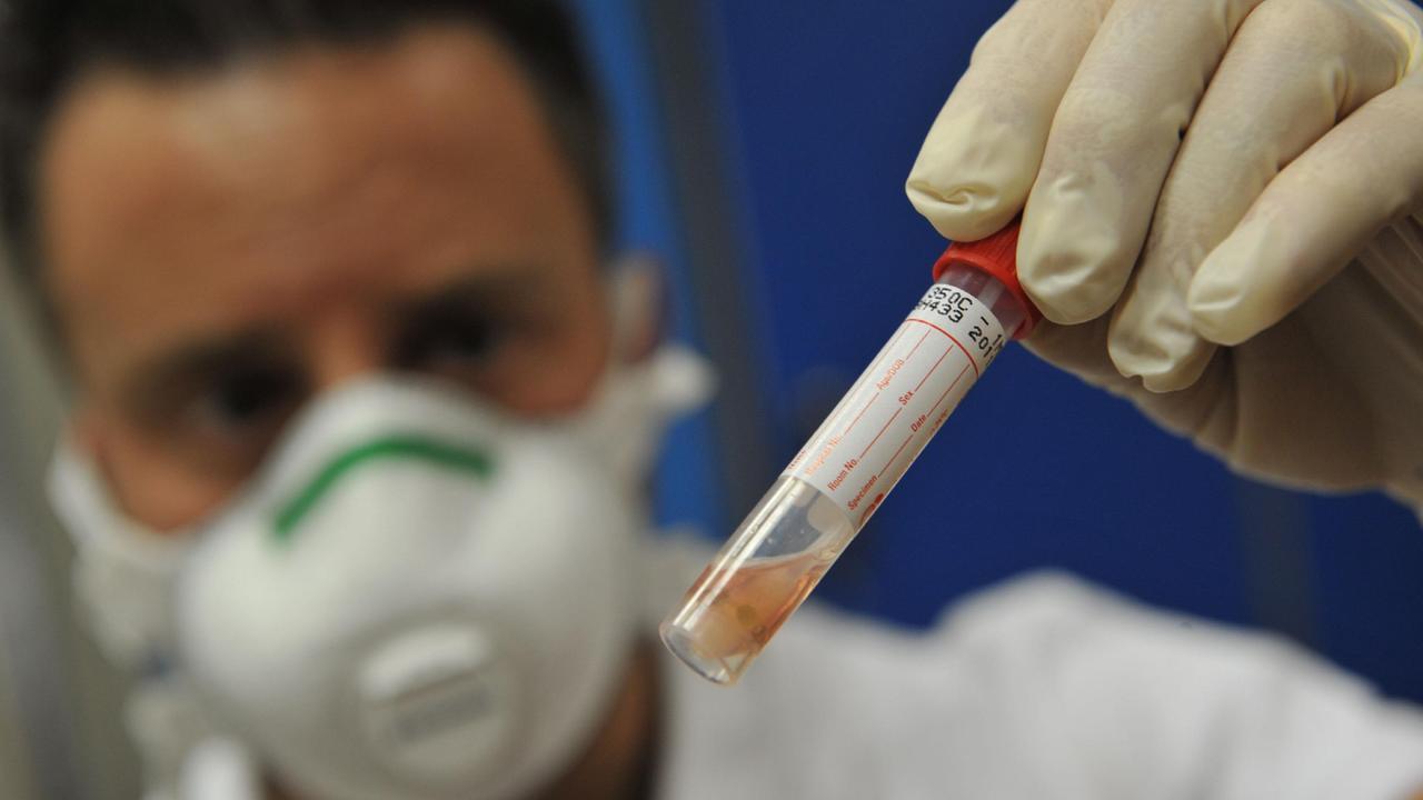 Immagine di repertorio di un laboratorio di analisi