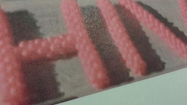 palloncini hiv, aids