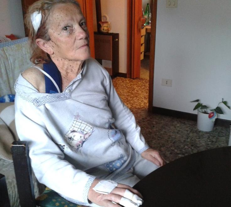 «Io, travolta da un’auto pirata in centro» 