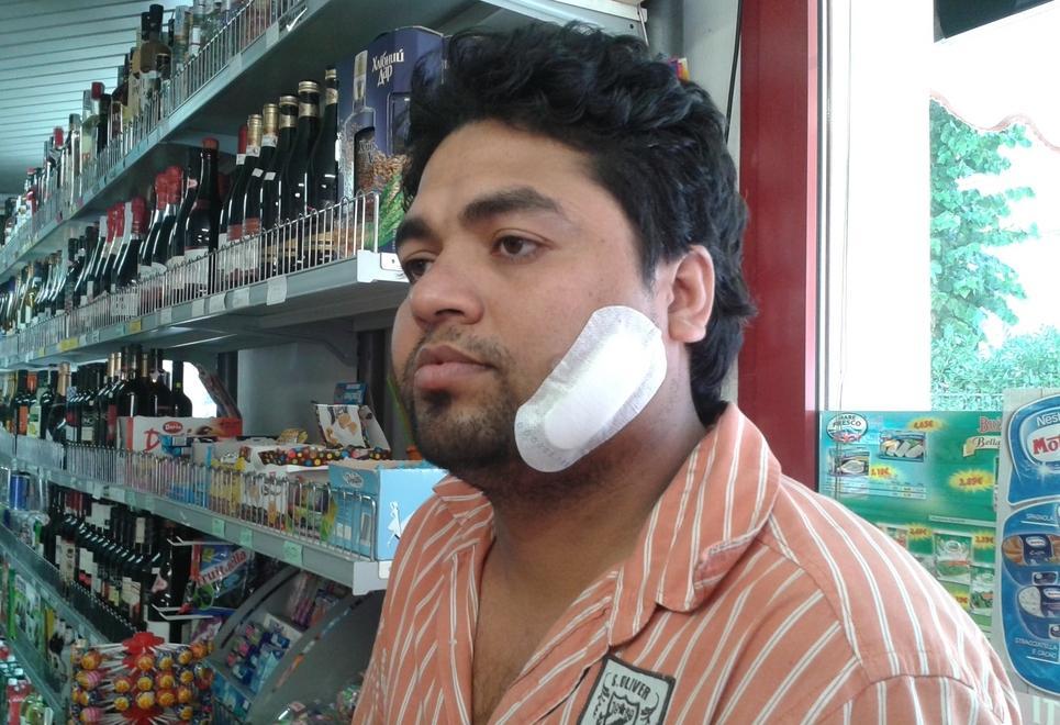 Rapina, sfregio e bottigliate: condannati 