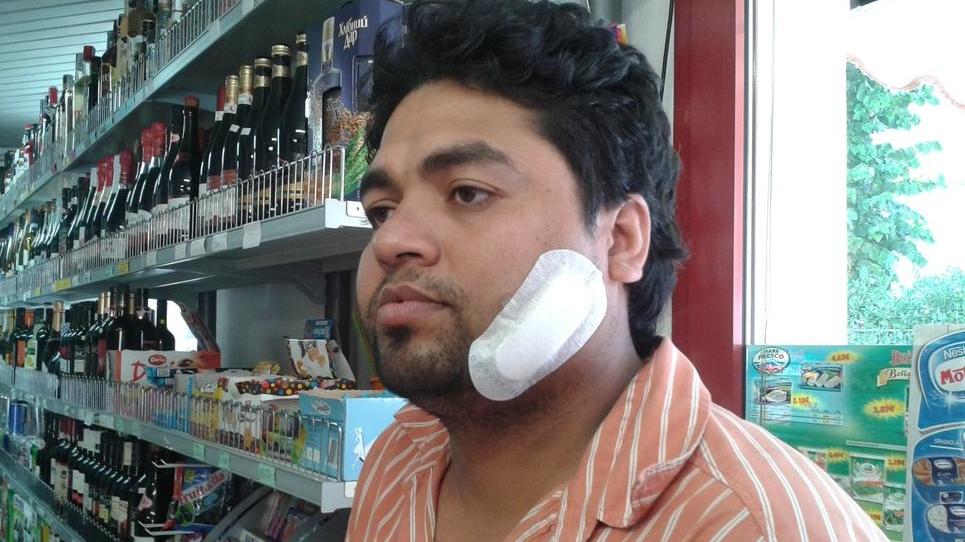 Rapina, sfregio e bottigliate: condannati