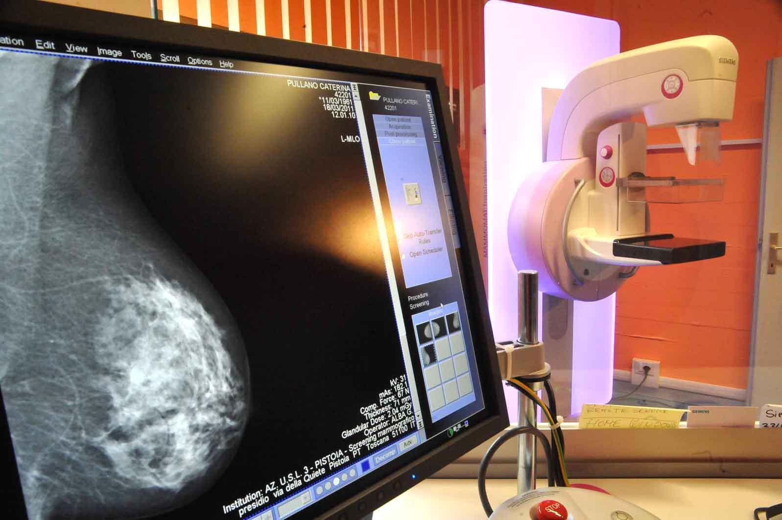 Mammografia, a Pescia esami sospesi fino a gennaio