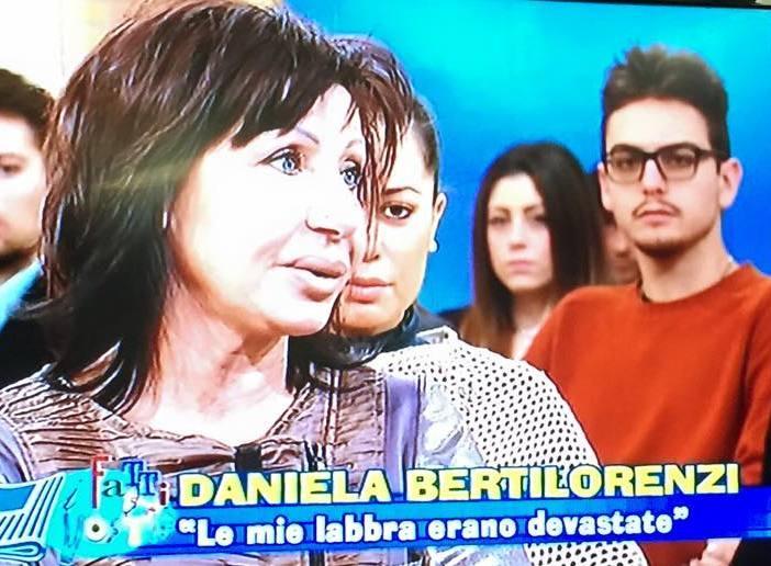 «Volevo essere più bella invece ero un mostro» 
