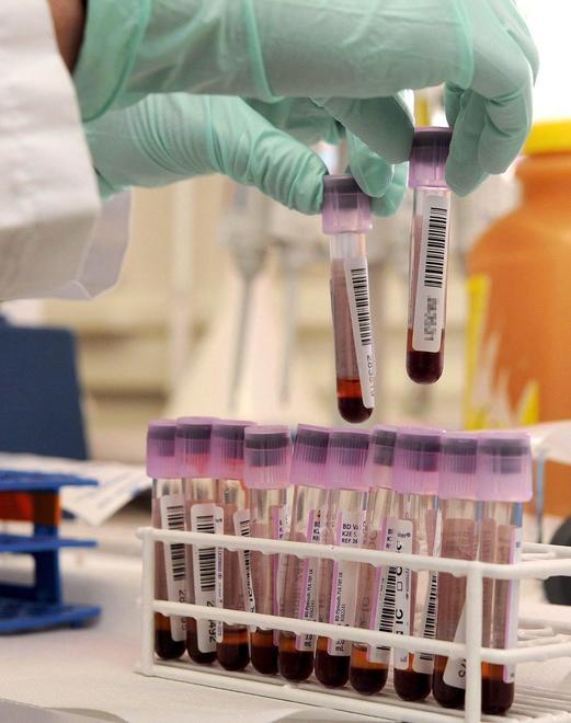 Un caso di epatite A, scatta la profilassi 
