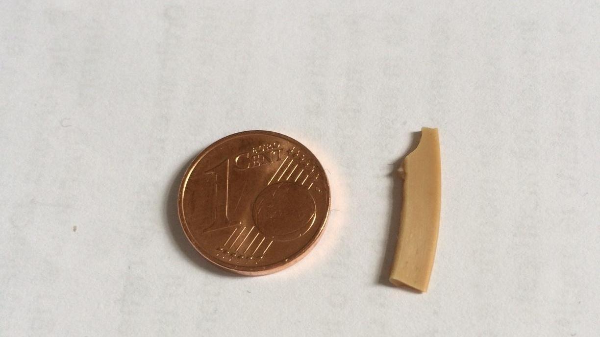Il pezzo di gomma trovato nella minestra di una maestra delle elementati Battisti