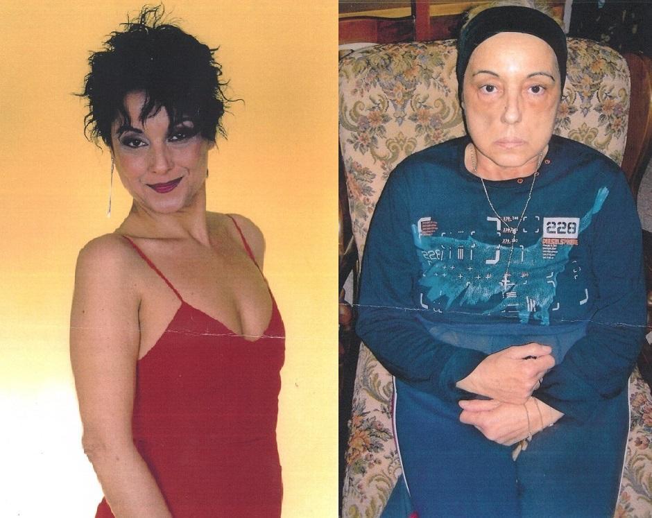 Sandra Pelosi qualche anno fa (a sinistra) e come è oggi (a destra)