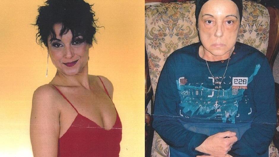 Sandra Pelosi qualche anno fa (a sinistra) e come è oggi (a destra)
