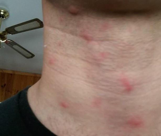 Allarme a Codigoro Torna la processionaria