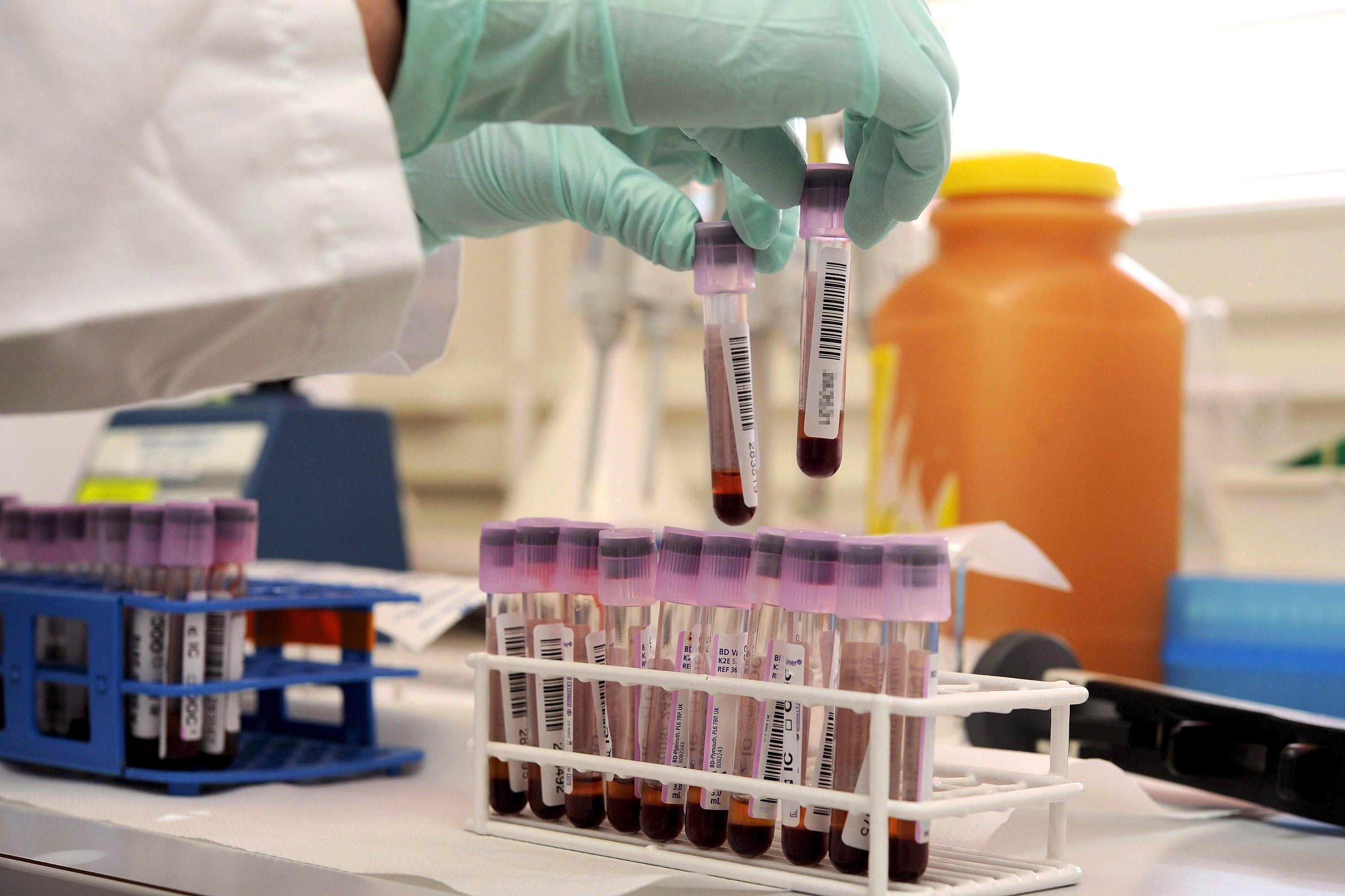 Provette in laboratorio