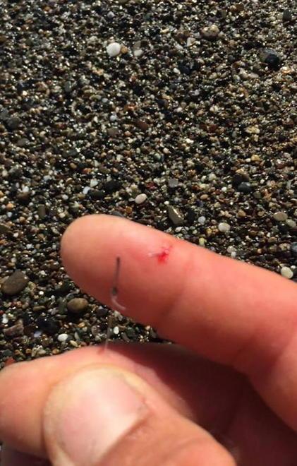 Ami in spiaggia, bagnino si ferisce 