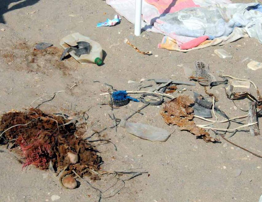 Ferro arrugginito in spiaggia, bimbo ferito ad un piede 