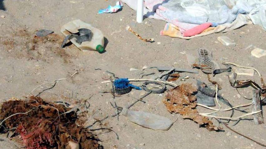 Ferro arrugginito in spiaggia, bimbo ferito ad un piede
