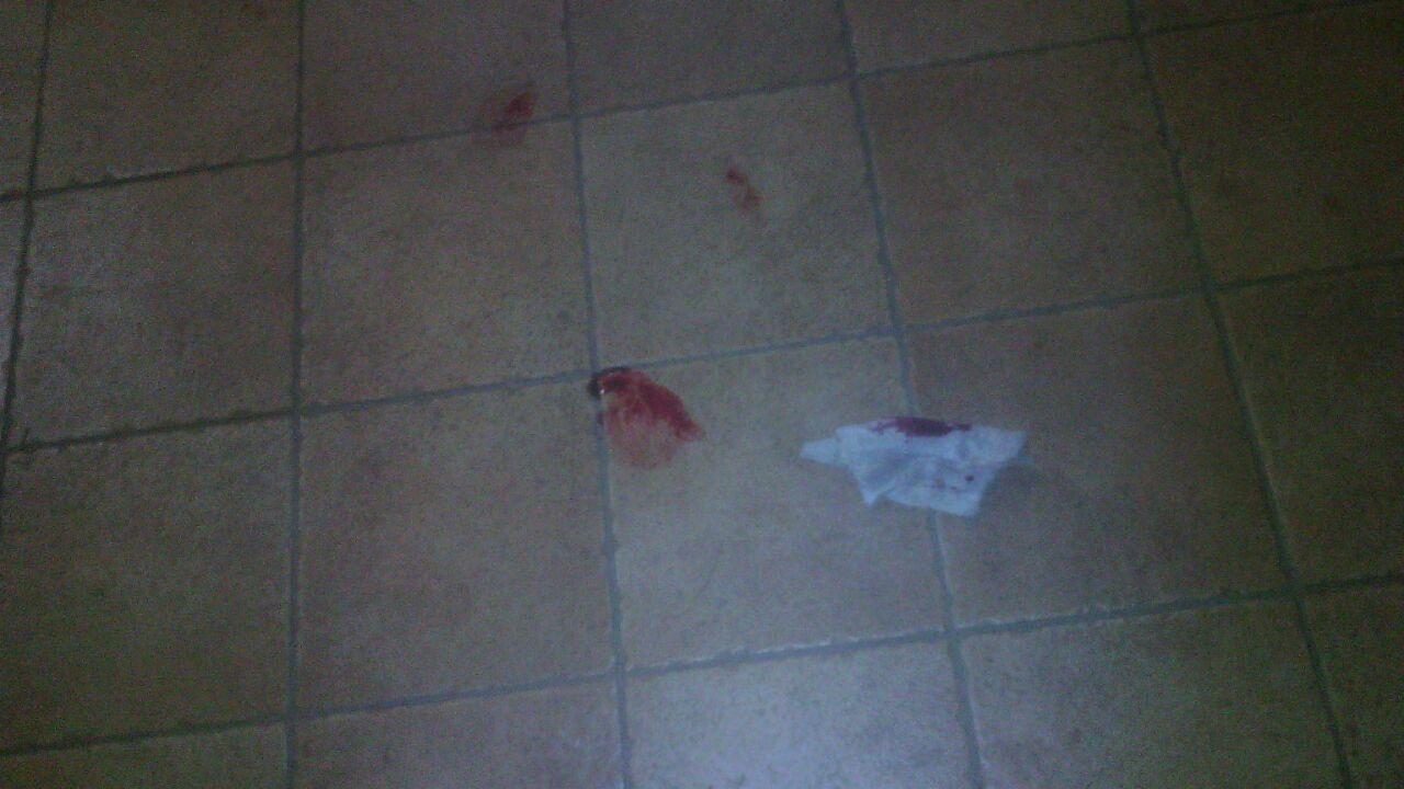 Tracce di sangiue sul pavimento dopo la rissa