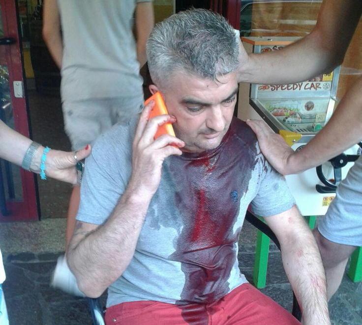 Dopo l’aggressione subita non riaprirà più il suo bar 