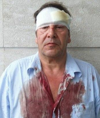 Giornalista e operatore tv aggrediti al campo rom