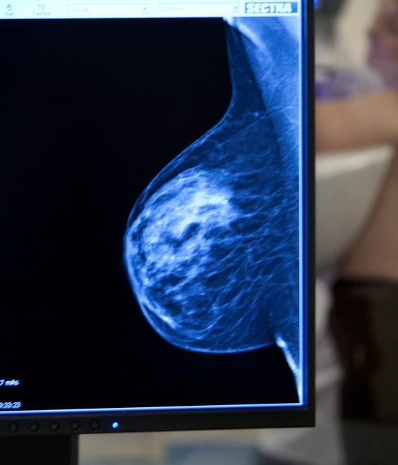 Lo screening mammografico resta gratuito