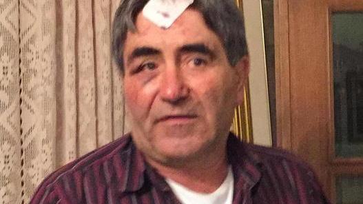 «Dentro ti resta un’ombra difficile da allontanare»