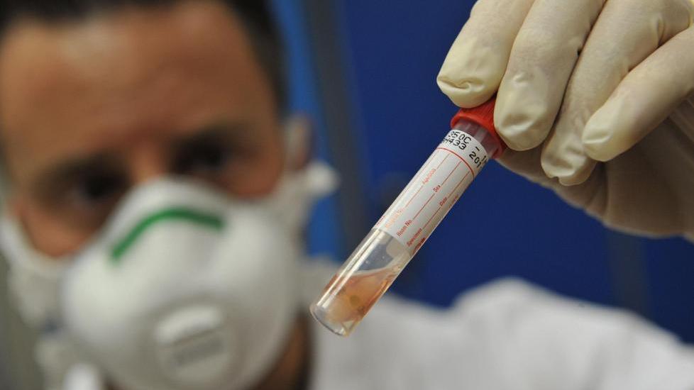 Le provette tornano gratis da domani