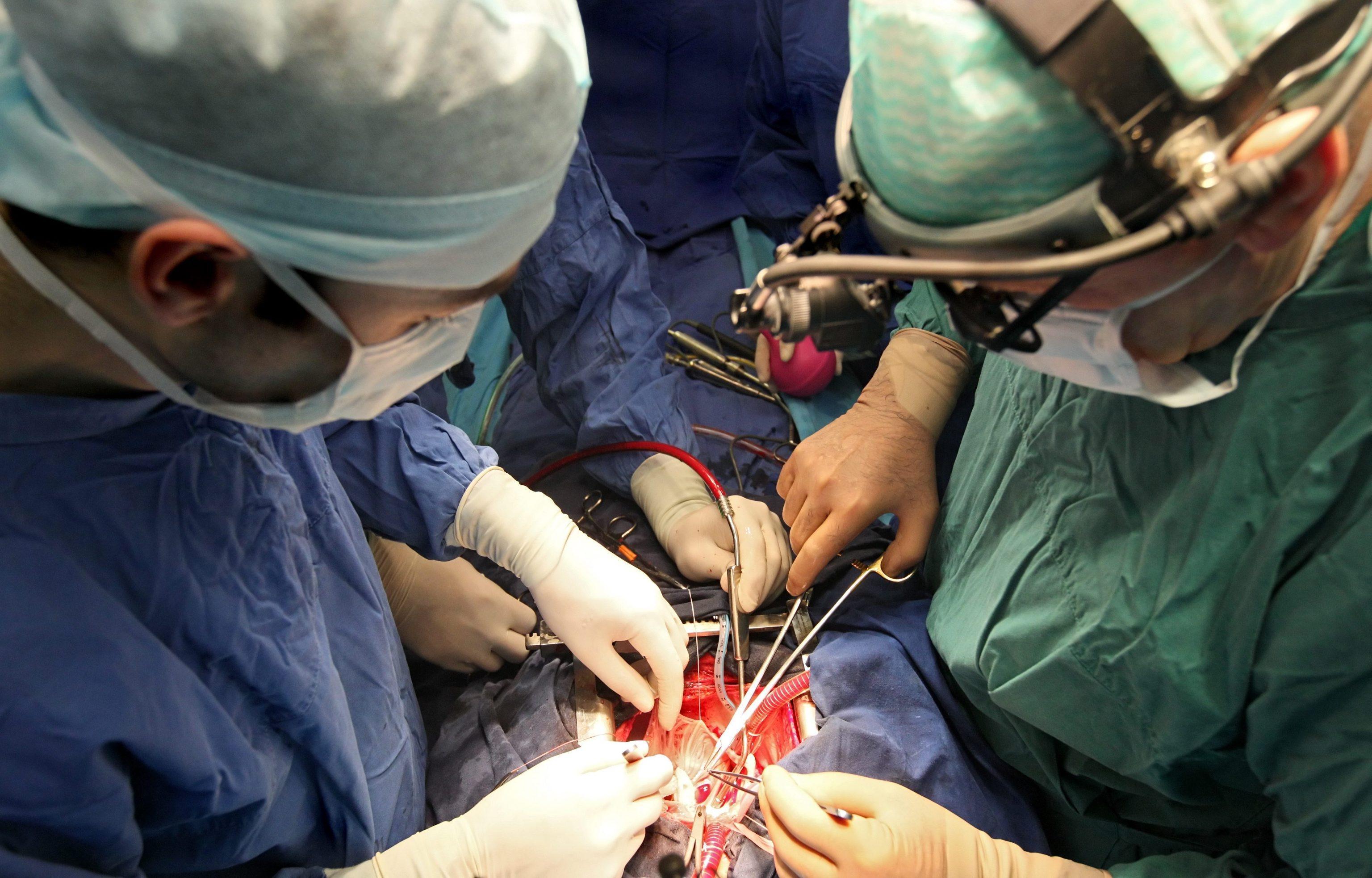 Un intervento di cardiochirurgia in un'immagine d'archivio