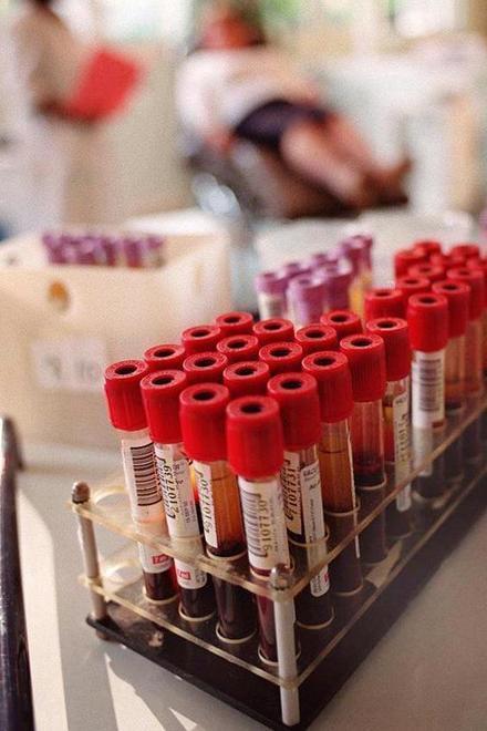 L’Aids fa ancora paura: a Cisanello seguiti 1.200 casi 